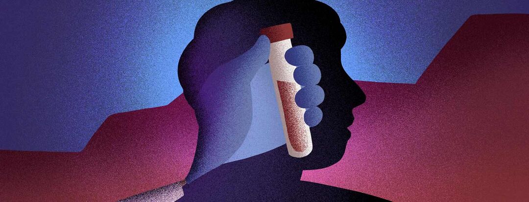 Navigating Disappointing Test Results image