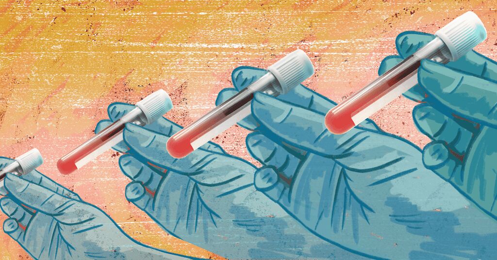 What Is Severe Hypertriglyceridemia (sHTG)?